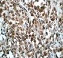 Immunohistochemistry (Formalin/PFA-fixed paraffin-embedded sections) - Nucleophosmin (phospho Y199) antibody [EP1857Y] (ab81551)