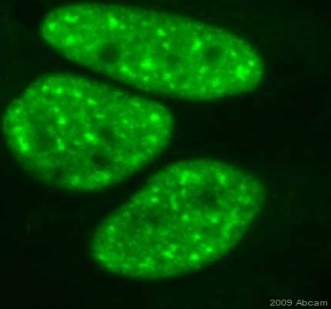 Immunocytochemistry/ Immunofluorescence - Nucleophosmin (phospho T199) antibody [EP1857Y] (ab81551)