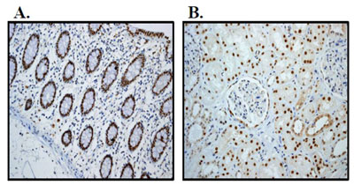 Immunohistochemistry (Formalin/PFA-fixed paraffin-embedded sections) - Anti-HNF-4-alpha antibody [EPR3648] (ab92378)