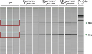 The QIAseq 16S/ITS Panels have very low levels of background contamination due to the use of reagents with low bioburden.