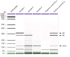 AdnaTest ER/PR-Detect results of samples analyzed with an Agilent 2100 Bioanalyzer