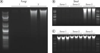 The new QIAamp PowerFecal Pro DNA Kit enables the isolation of larger amounts of high-quality DNA.