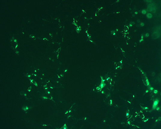 IL 22BP cDNA ORF Clone Human C DDK Flag tag 炼石商城