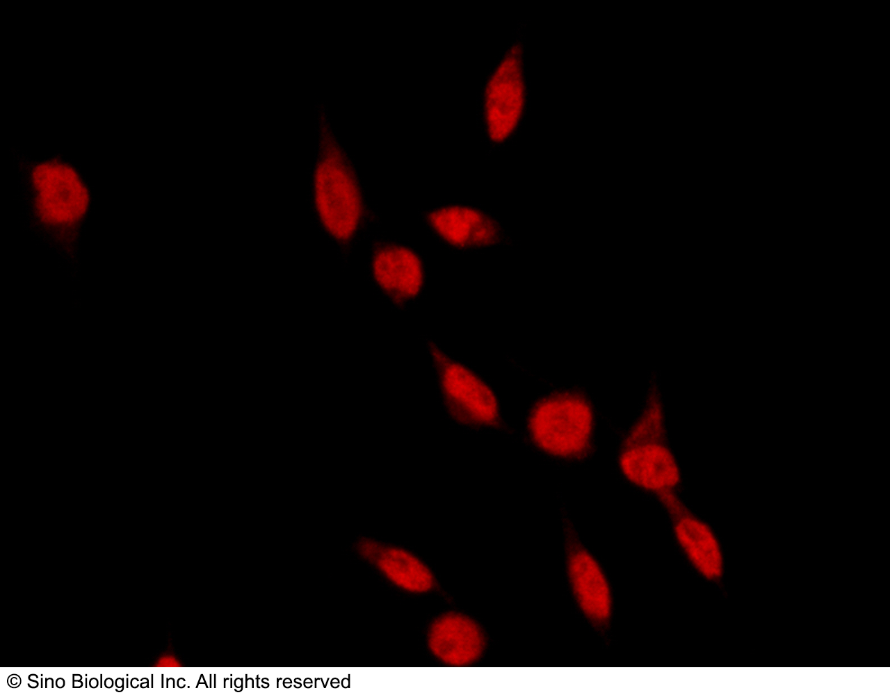 Human RAD18 Immunofluorescence(IF) 2767