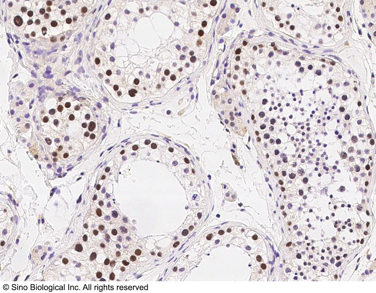Human RAD18 Immunohistochemistry(IHC) 3709