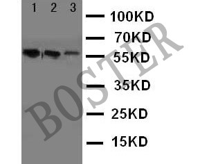 angiotensinogen(ba3669-2)(mw:56kd)小鼠肝,大鼠