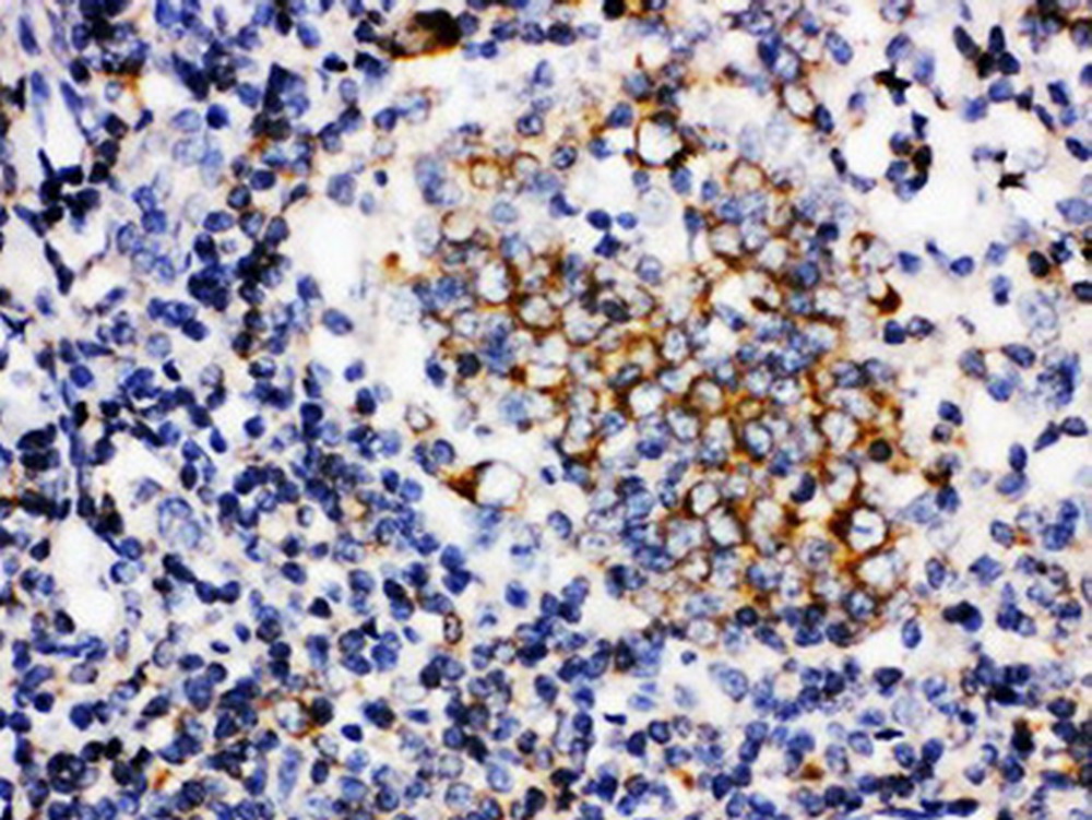 baff(ba4037)扁桃体标本,石蜡切片,sabc法,dab显色.